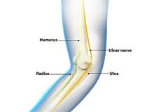 Ulnar Nerve Transposition